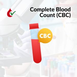 Complete Blood Count (CBC)